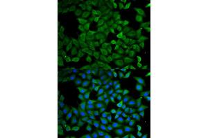 Immunofluorescence analysis of  cells using  antibody (ABIN6129646, ABIN6137275, ABIN6137276 and ABIN6220922). (ATL1 抗体  (AA 1-280))