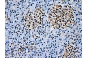 Immunohistochemical staining of paraffin-embedded Ovary tissue using anti-GBE1 mouse monoclonal antibody. (GBE1 抗体)