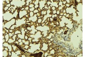 ABIN6274431 at 1/100 staining Mouse lung tissue by IHC-P. (PPHLN1 抗体  (N-Term))