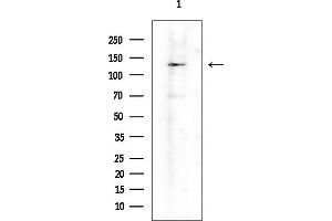 Western blot analysis of lysates from Mouse testis, using ADAMTS18 Antibody at 1/1000 dilution.