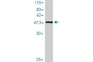 Western Blot detection against Immunogen (49. (RAB39B 抗体  (AA 1-213))