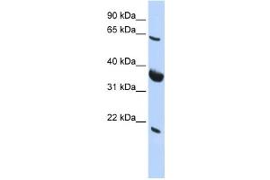 Western Blotting (WB) image for anti-Signal Recognition Particle Receptor (Docking Protein) (SRPR) antibody (ABIN2458501) (SRPR 抗体)