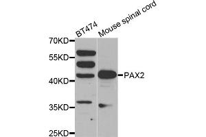 Western blot analysis of extracts of various cell lines, using PAX2 antibody (ABIN1874046) at 1:500 dilution. (PAX2A 抗体)