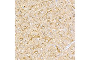 Immunohistochemistry of paraffin-embedded rat brain using NgR3 Rabbit mAb (ABIN7269932) at dilution of 1:50 (40x lens). (RTN4RL1 抗体)