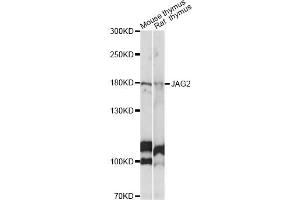 Western blot analysis of extracts of various cell lines, using JAG2 antibody (ABIN6291337) at 1:1000 dilution. (JAG2 抗体)