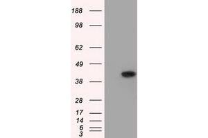 Image no. 1 for anti-Acetyl-CoA Acetyltransferase 2 (ACAT2) antibody (ABIN1496401) (ACAT2 抗体)