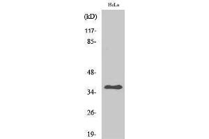 Western Blotting (WB) image for anti-Arginase, Type II (ARG2) (C-Term) antibody (ABIN3180496)