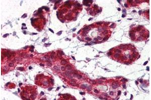 Human Breast (formalin-fixed, paraffin-embedded) stained with Heat Shock Protein 90 (HSP90) antibody ABIN364328 at 5 ug/ml followed by biotinylated anti-mouse IgG secondary antibody ABIN481714, alkaline phosphatase-streptavidin and chromogen. (HSP90 抗体  (AA 1-732))