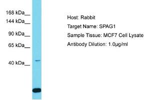 Host: Rabbit Target Name: SPAG1 Sample Tissue: Human MCF7 Whole Cell Antibody Dilution: 1ug/ml (SPAG1 抗体  (N-Term))