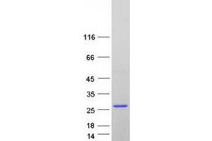 Validation with Western Blot