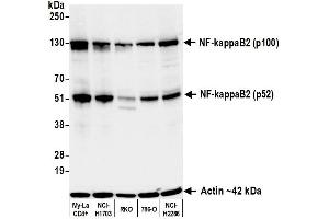 Western Blotting (WB) image for anti-NF-KappaB2 (/p52) (AA 1-50) antibody (ABIN7795782) (Recombinant NF-KappaB2 (/p52) (AA 1-50) 抗体)