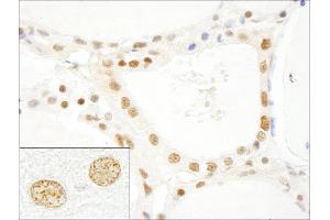 Immunohistochemistry (IHC) image for anti-LUC7-Like 3 (LUC7L3) (AA 1-50) antibody (ABIN7448489) (LUC7-Like 3 抗体  (AA 1-50))