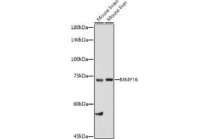 Western blot analysis of extracts of various cell lines, using MMP16 antibody (ABIN6132356, ABIN6143906, ABIN6143907 and ABIN6214654) at 1:1000 dilution. (MMP16 抗体  (AA 290-565))
