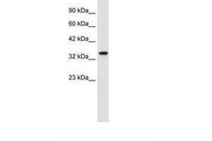Image no. 1 for anti-Zinc Finger Protein 2 (ZNF2) (AA 124-173) antibody (ABIN202176) (ZNF2 抗体  (AA 124-173))