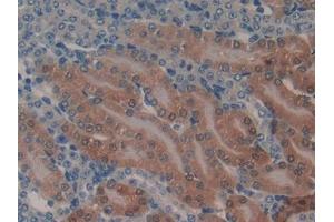 DAB staining on IHC-P; Samples: Mouse Kidney Tissue (GSTA1 抗体  (AA 2-223))