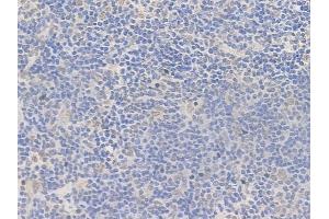 ABIN7095687 and ABIN7099749 at 1/100 staining human normal tonsil tissue by IHC-P.
