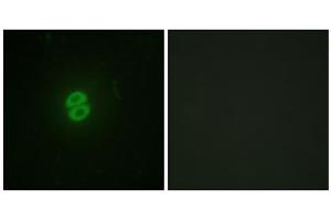 Immunofluorescence analysis of A549 cells, using CD253 antibody. (TRAIL 抗体  (Internal Region))