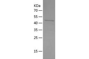 Western Blotting (WB) image for Solute Carrier Family 22 (Organic Cation Transporter), Member 2 (SLC22A2) (AA 1-200) protein (His-IF2DI Tag) (ABIN7283540) (SLC22A2 Protein (AA 1-200) (His-IF2DI Tag))