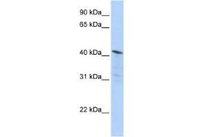 WB Suggested Anti-HDAC11 Antibody Titration:  0. (HDAC11 抗体  (Middle Region))