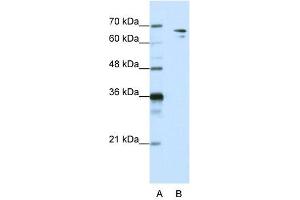 WB Suggested Anti-SF1  Antibody Titration: 1. (Splicing Factor 1 抗体  (N-Term))