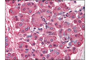 Image no. 1 for anti-SKI Proto-Oncogene (SKI) (N-Term) antibody (ABIN303247) (SKI 抗体  (N-Term))