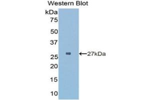 Western Blotting (WB) image for anti-HLA Class II DR alpha (HLA-DRA) (AA 28-232) antibody (ABIN1175589) (HLA-DRA 抗体  (AA 28-232))