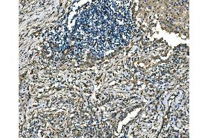 IHC analysis of RAB13 using anti-RAB13 antibody (ABIN7600599).