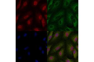ABIN6257418 and ABIN6273806 staining  cells by IF/ICC. (PKC iota 抗体  (Internal Region))