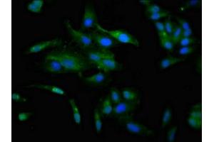 Immunofluorescence staining of Hela cells with ABIN7147596 at 1:100, counter-stained with DAPI. (CCKAR 抗体  (AA 235-313))