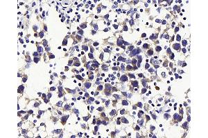 Immunohistochemistry (Paraffin-embedded Sections) (IHC (p)) image for anti-Solute Carrier Family 2 (Facilitated Glucose Transporter), Member 3 (SLC2A3) antibody (ABIN7249616)