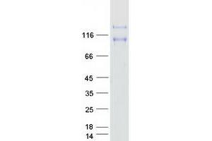 Western Blotting (WB) image for Protein tyrosine Phosphatase, Receptor Type, A (PTPRA) (Transcript Variant 3) protein (Myc-DYKDDDDK Tag) (ABIN2730126)