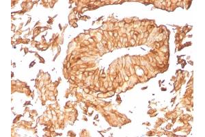 Immunohistochemistry (IHC) image for anti-Uroplakin 1B (UPK1B) (AA 109-229) antibody (ABIN6940857)