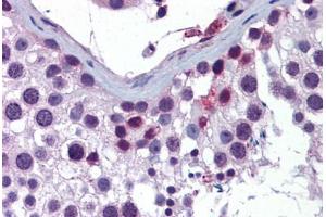 Human Testis: Formalin-Fixed, Paraffin-Embedded (FFPE) (ING4 抗体  (AA 110-159))