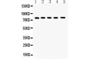 Western blot analysis of FSH Receptor expression in rat testis extract ( Lane 1), rat ovary extract ( Lane 2), mouse testis extract ( Lane 3) mouse ovary extract ( Lane 4) and HELA whole cell lysates ( Lane 5). (FSHR 抗体  (AA 18-187))