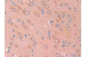 Detection of CA12 in Rat Cerebrum Tissue using Polyclonal Antibody to Carbonic Anhydrase XII (CA12) (CA12 抗体  (AA 154-307))