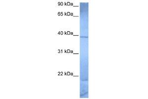 WB Suggested Anti-ZNF121 Antibody Titration:  0. (ZNF121 抗体  (Middle Region))