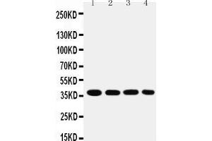 Western Blotting (WB) image for anti-Cytochrome C Oxidase Subunit I (COX1) (AA 2-14), (N-Term) antibody (ABIN3042632)