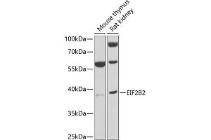 Western blot analysis of extracts of various cell lines, using EIF2B2 antibody (ABIN6132131, ABIN6140037, ABIN6140038 and ABIN6222805) at 1:1000 dilution. (EIF2B2 抗体  (AA 1-351))