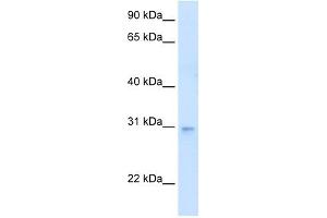 LDB3 antibody used at 0. (LIM Domain Binding 3 Protein 抗体  (N-Term))