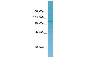 WB Suggested Anti-CNKSR2 Antibody Titration: 1. (CNKSR2 抗体  (C-Term))