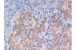 Immunohistochemistry (IHC) image for anti-Complement Component C9 (C9) (AA 22-265) antibody (ABIN7434128)
