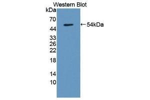 Western Blotting (WB) image for anti-Transmembrane Protein 27 (TMEM27) (AA 15-141) antibody (ABIN1871658) (TMEM27 抗体  (AA 15-141))