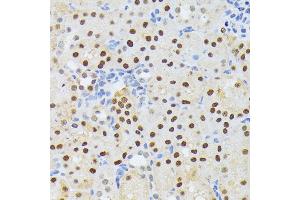 Immunohistochemistry of paraffin-embedded mouse kidney using EL antibody (ABIN6132052, ABIN6140108, ABIN6140109 and ABIN6222942) at dilution of 1:200 (40x lens). (ELAC2 抗体  (AA 1-270))