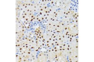 Immunohistochemistry of paraffin-embedded mouse kidney using EL antibody (ABIN6132052, ABIN6140108, ABIN6140109 and ABIN6222942) at dilution of 1:200 (40x lens). (ELAC2 抗体  (AA 1-270))