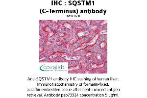 Image no. 1 for anti-Sequestosome 1 (SQSTM1) (C-Term) antibody (ABIN1739629) (SQSTM1 抗体  (C-Term))