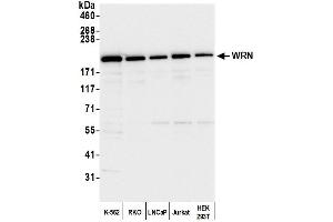 anti-Werner syndrome RecQ like helicase (WRN) (AA 400-450) antibody