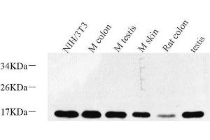 Western Blot analysis of various samples using Survivin Polyclonal Antibody at dilution of 1:600. (Survivin 抗体)
