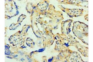 Immunohistochemistry of paraffin-embedded human placenta tissue using ABIN7171585 at dilution of 1:100 (TTBK2 抗体  (AA 1185-1244))