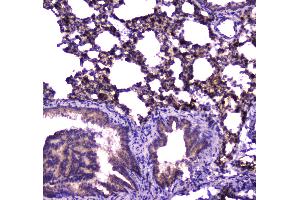 IHC analysis of FABP5 using anti-FABP5 antibody . (FABP5 抗体)