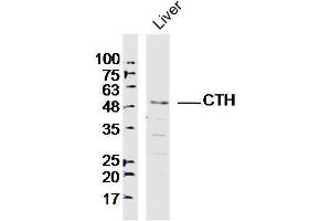 Lane 1: Mouse liver lysates probed with CTH Polyclonal Antibody, Unconjugated  at 1:300 overnight at 4˚C. (CTH 抗体)